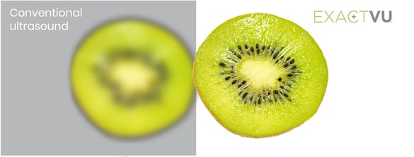 kiwi-graphic
