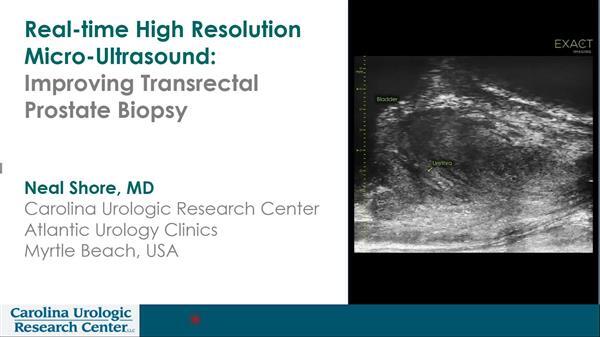 Micro-Ultrasound System from Grand Rounds in Urology