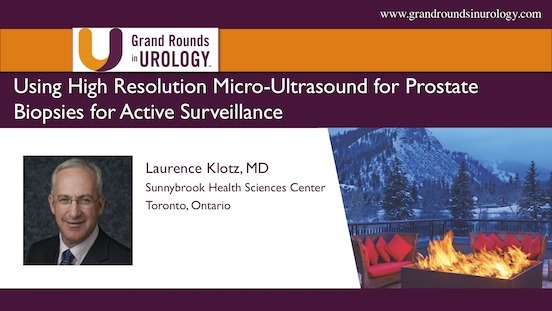 Using High Resolution Micro-Ultrasound for Prostate Biopsies for Active Surveillance