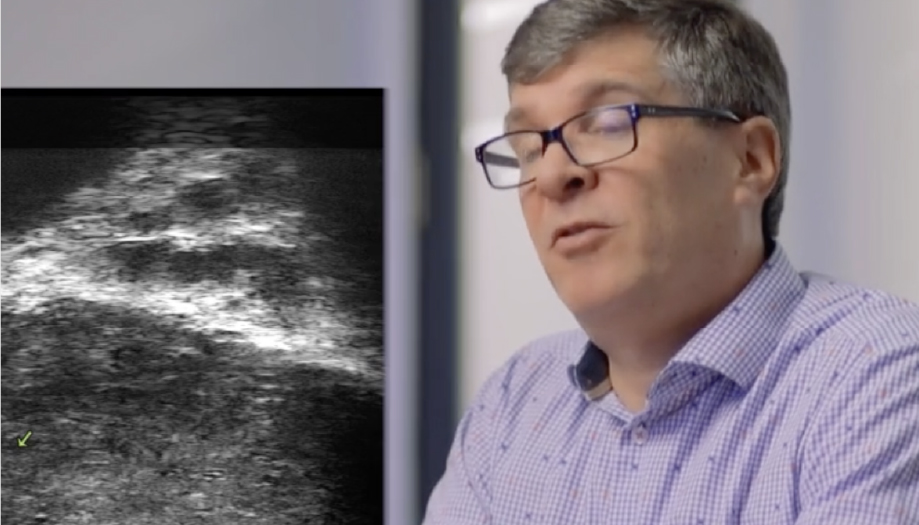 Rob Sandler for Prostate Cancer Canada